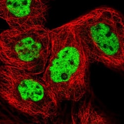 RBM12 Antibody, Novus Biologicals 0.1mL; Unlabeled:Antibodies, Polyclonal